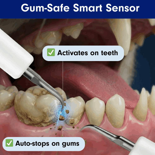 Silent Ultrasonic Teeth Cleaner for Cats